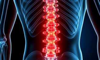 Межпозвоночная грыжа: как лечить и вернуть привычную жизнь
